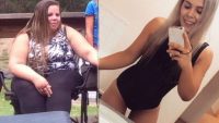 Obez anne 75 kiloya düştü! Son hali şaşırttı…