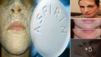 Aspirinin Ciltteki Mucizevi Etkisi